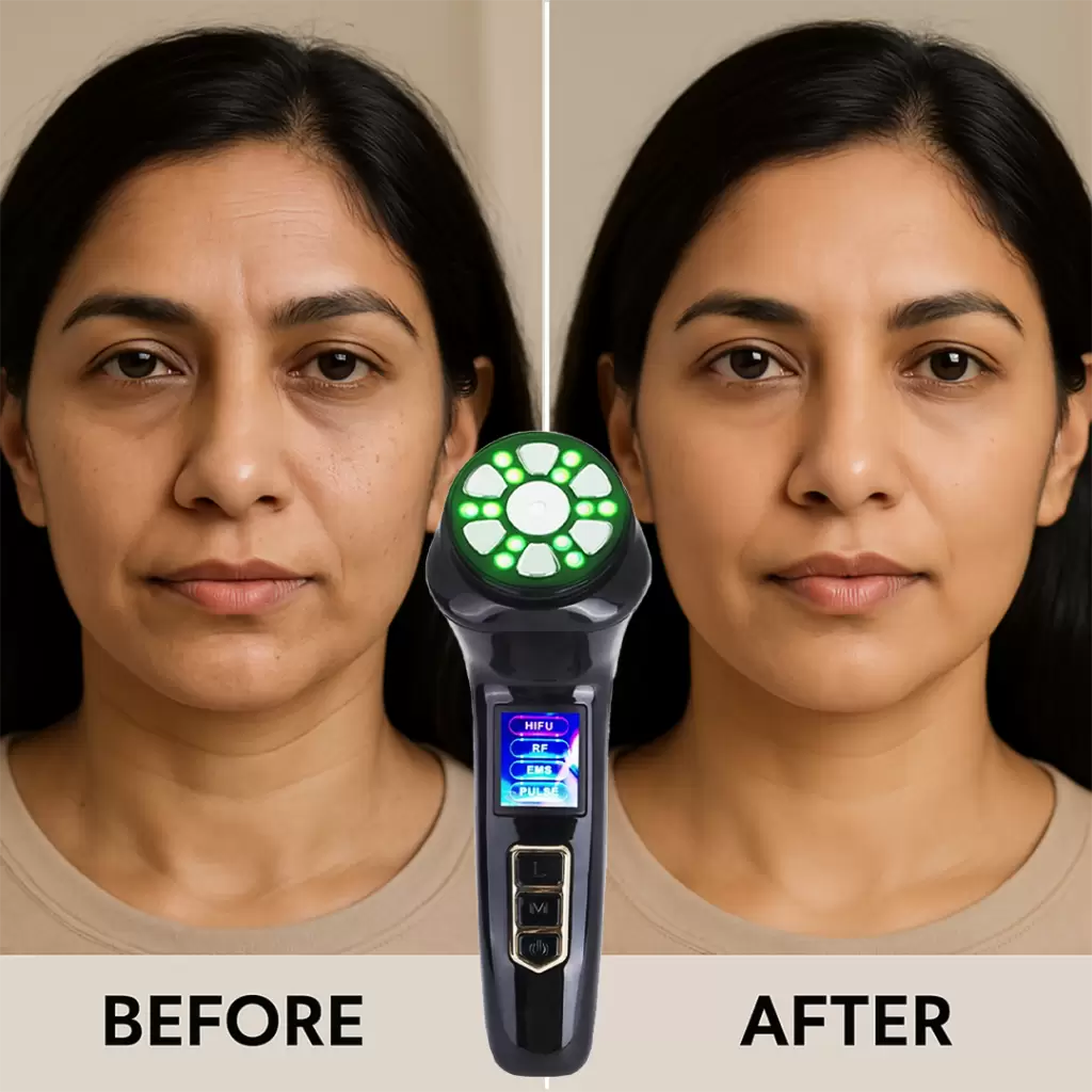 Minicare HIFU 3rd generation skin tightening device